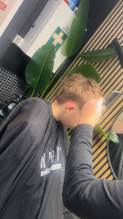 A child's cut being finished with spray.